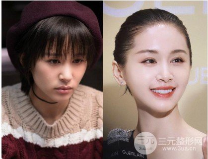 王子文變樣被疑整容