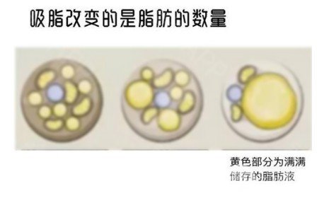 大腿肉注射瘦腿能打嗎