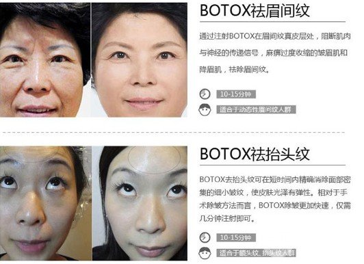 ****注射瘦臉的價格多少