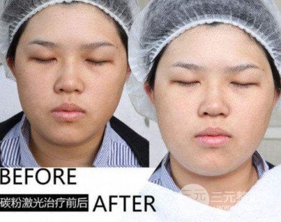 做黑臉娃娃的費用多少