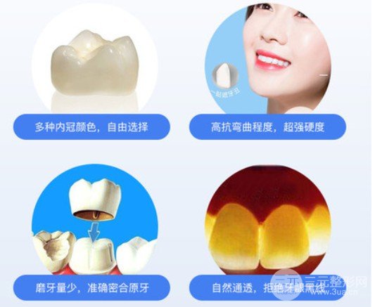 全瓷烤瓷牙價格