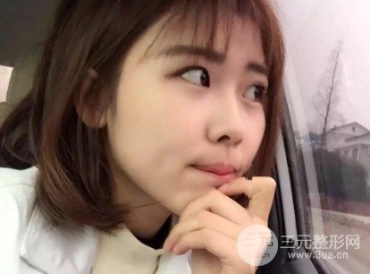 玻尿酸隆鼻對比圖