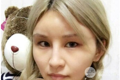 芭比眼睛雙眼皮圖片