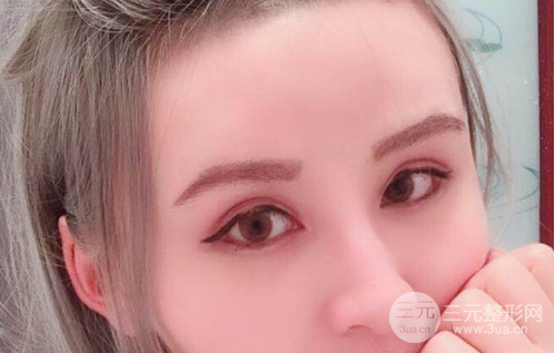 芭比眼睛雙眼皮圖片