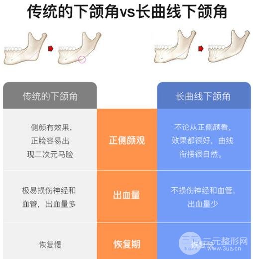 磨下頜骨要多少錢