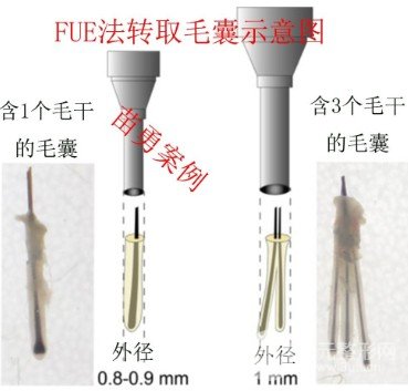 2020年度深圳植發(fā)醫(yī)院排行