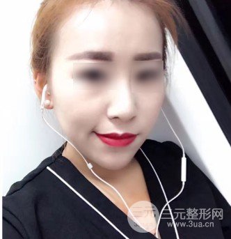 打注射瘦臉降低風(fēng)險(xiǎn)嗎