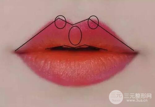 M唇手術(shù)方法：