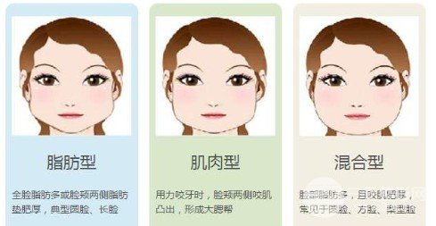 注射瘦臉?lè)磸椖槙?huì)更大嗎