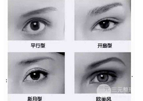 做雙眼皮開眼角注意事項