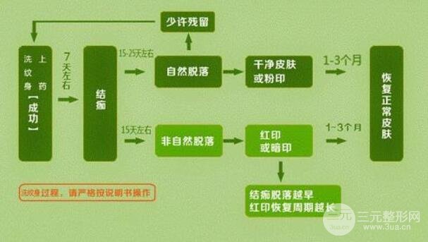 洗紋身事項(xiàng)問與答：