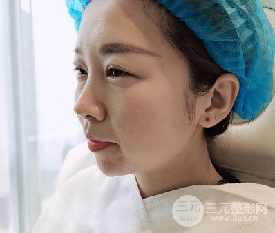 下巴短整形要怎么做