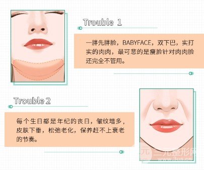 面部吸脂會(huì)反彈嗎