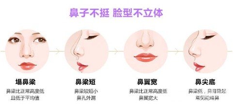 自體軟骨隆鼻的價(jià)格貴嗎