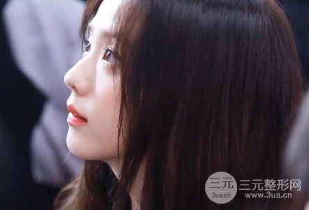 眼袋切除術(shù)后多久恢復(fù)