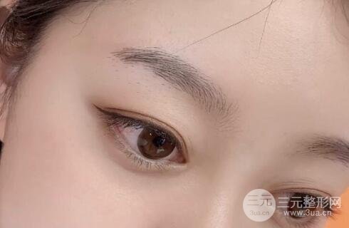 紋眉手術(shù)前