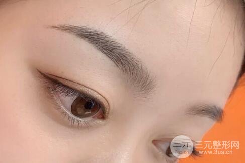 紋眉手術(shù)中