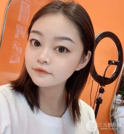 紋眉手術(shù)后