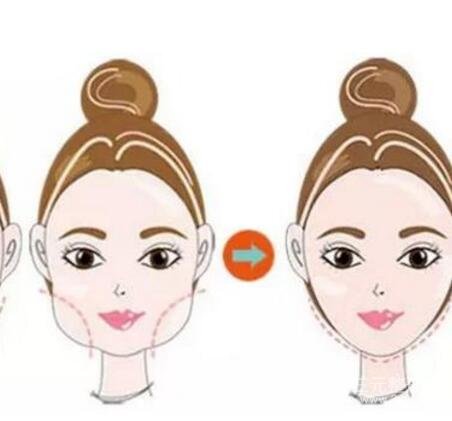 什么是微創(chuàng)改臉型