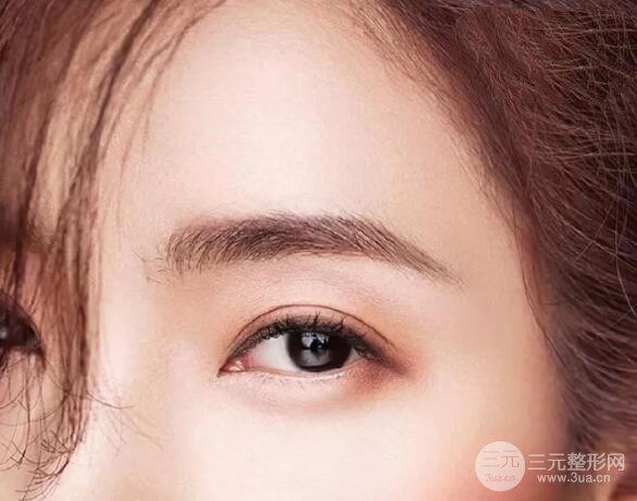 單眼皮整容前后照片真人術(shù)后展示，靈光大眼好吸睛~