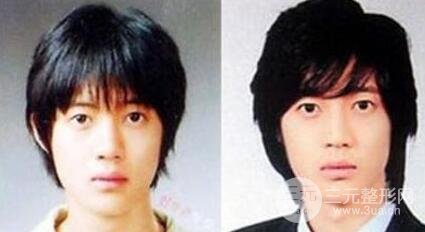 金賢重對整形的回應(yīng)