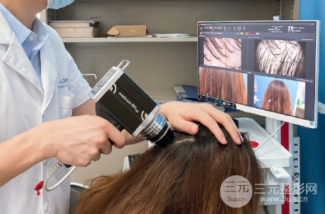 河南植發(fā)正規(guī)醫(yī)院收費標準