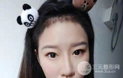 河南植發(fā)正規(guī)醫(yī)院收費標準