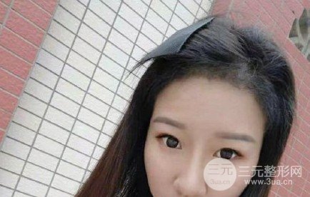 河南植發(fā)正規(guī)醫(yī)院收費標準