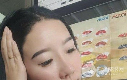 河南植發(fā)正規(guī)醫(yī)院收費標準