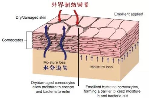來(lái)了！你的敏感皮膚“自救”指南