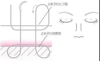 日本*醫(yī)志|二十年如一日，專注埋線雙眼皮的整形大師~