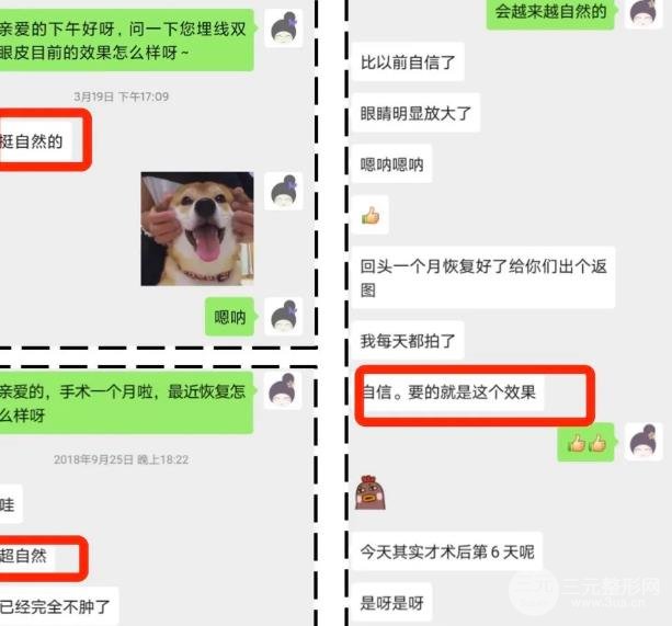 日本*醫(yī)志|二十年如一日，專注埋線雙眼皮的整形大師~