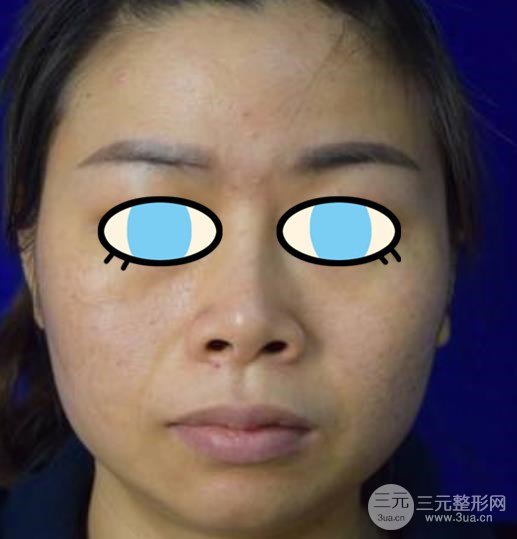 日本*醫(yī)志|精益求精，鼻部修復(fù)大師橫山才也~