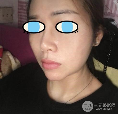 日本*醫(yī)志|精益求精，鼻部修復(fù)大師橫山才也~