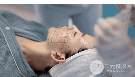 做熱瑪吉有什么后遺癥