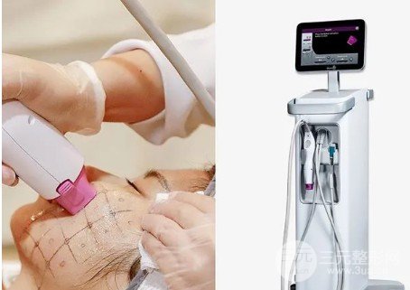 熱瑪吉和埋線除皺哪個(gè)好