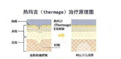 為什么有些人在完成熱瑪吉后沒有果?