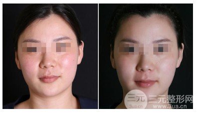 新一代熱瑪吉900發(fā)多少錢