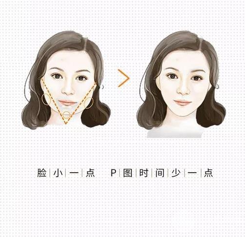 注射注射瘦臉的注意事項: