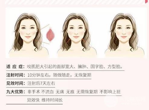 注射瘦臉適應(yīng)癥