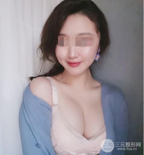 上海九院隆胸案例術(shù)后3個月