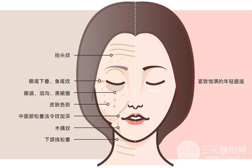 中面部除皺術(shù)后恢復大概要多久?