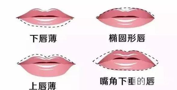 注射玻尿酸豐唇多少錢一針?