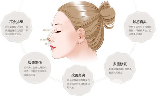 自體耳軟骨隆鼻價(jià)錢是多少?