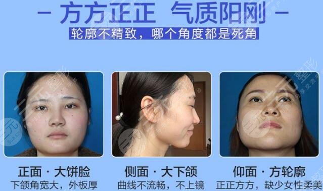 術(shù)前注意事項(xiàng)