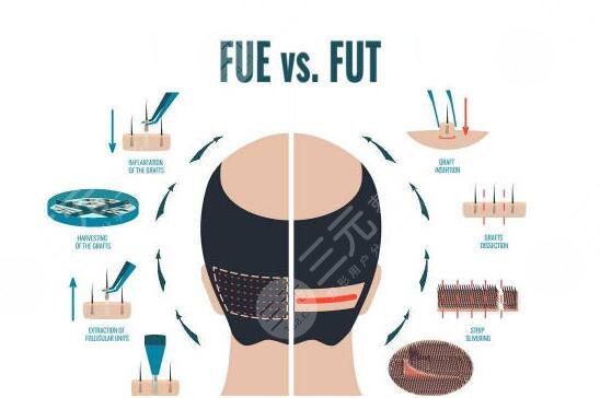 成都植發(fā)醫(yī)院排行:實力派靠譜植發(fā)機構(gòu)盤點~