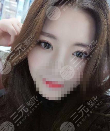 哈醫(yī)大一院整形美容中心激光去眼袋