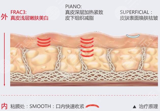優(yōu)點(diǎn)對比