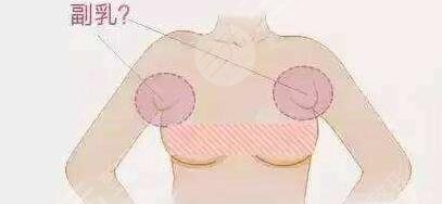 手術(shù)恢復(fù)