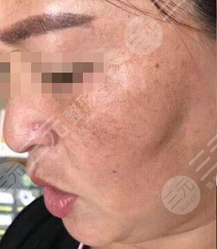 北京火箭軍總醫(yī)院激光整形美容中心